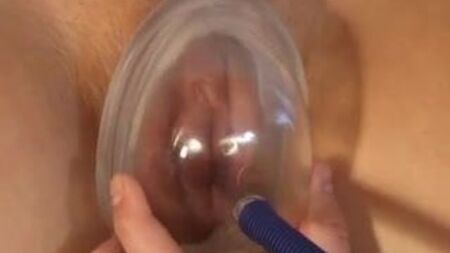 Bomba vaginal
