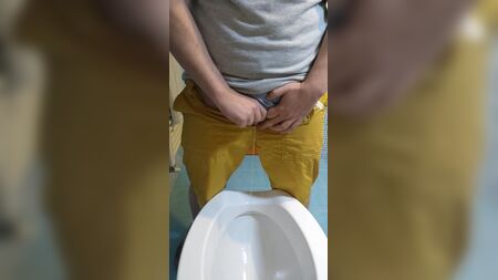 Metoidioplastia en hombres trans que orinan de pie
